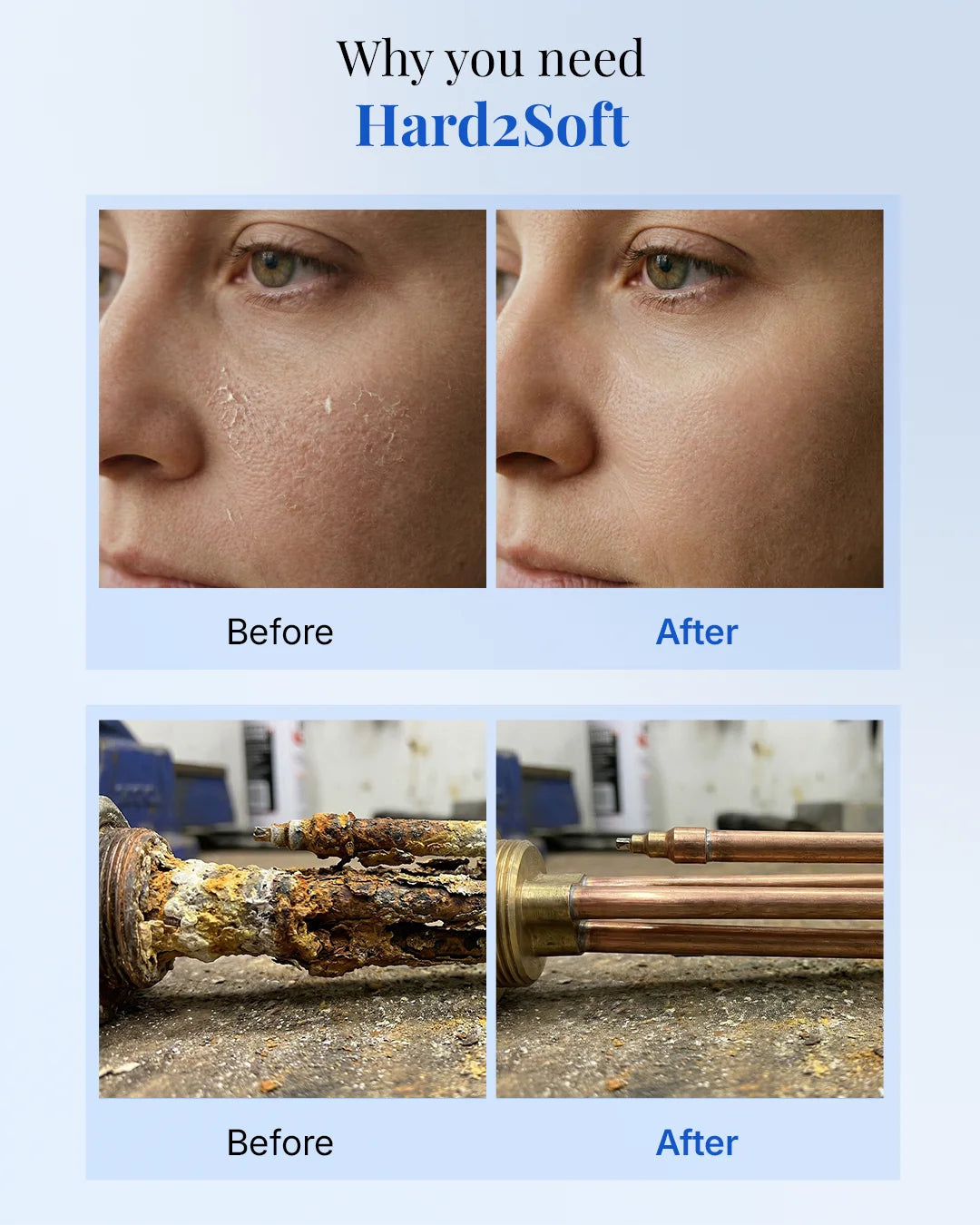 Hard2Soft hard water conditioner results – improved skin and scale-free pipes before and after comparison